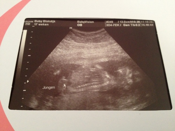 17 weken Echo van de geslachtsbepaling. It's a boy :-) !!