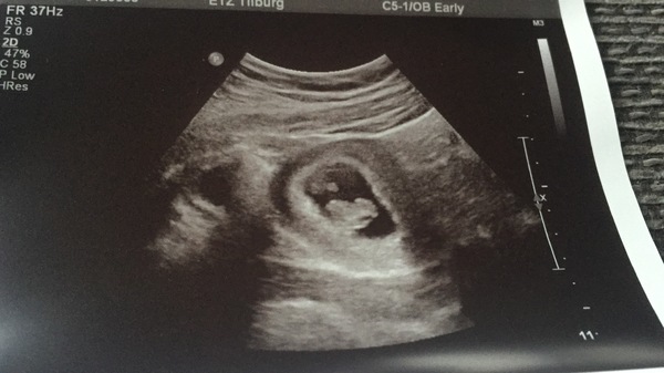  Eerste echo! 
8 weken& 2 dagen