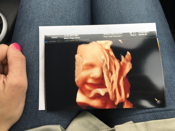 Kleine moppie Vandaag de 3/4D echo gehad met onze familie ❤️