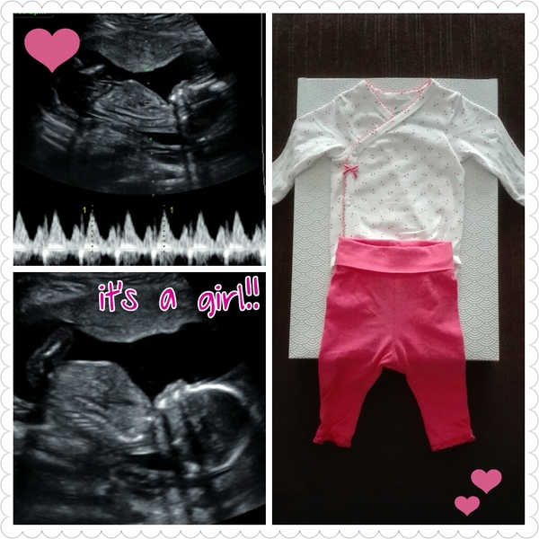 It's a girl!!! 