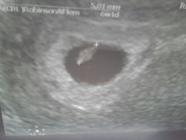  Eerste echo