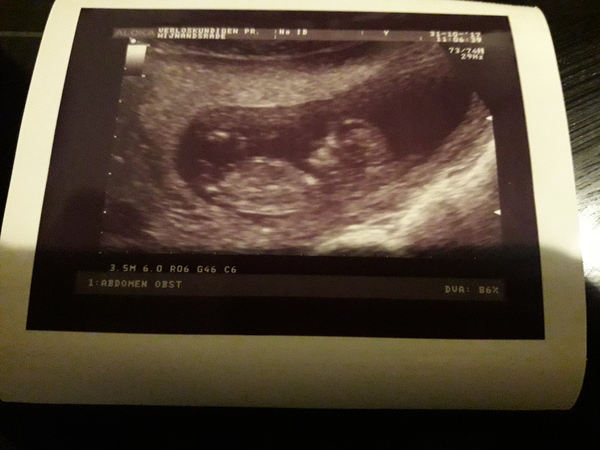 11w5d 