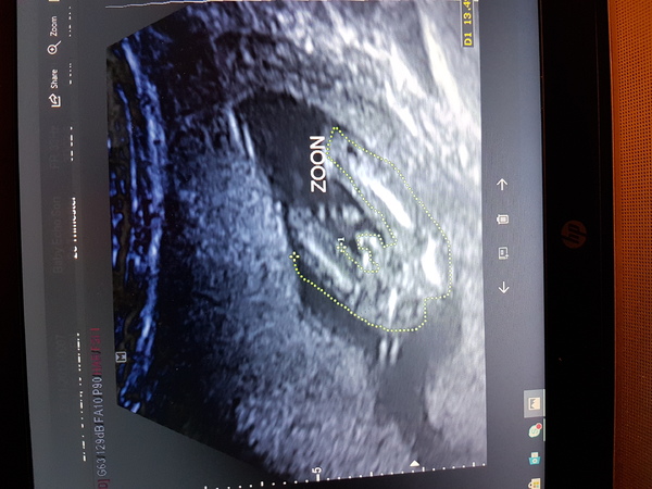 Its a boy! 