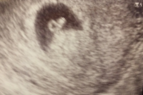 Eerste echo bij 6w3d 9-2-2018: Alles zag er goed uit en er was zelfs al een knipperende pixel, het hartje klopt <3 Over 2 weken de volgende echo.