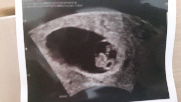 Eerste echo 19-4 7w3d
