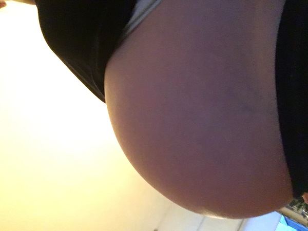30+1 
