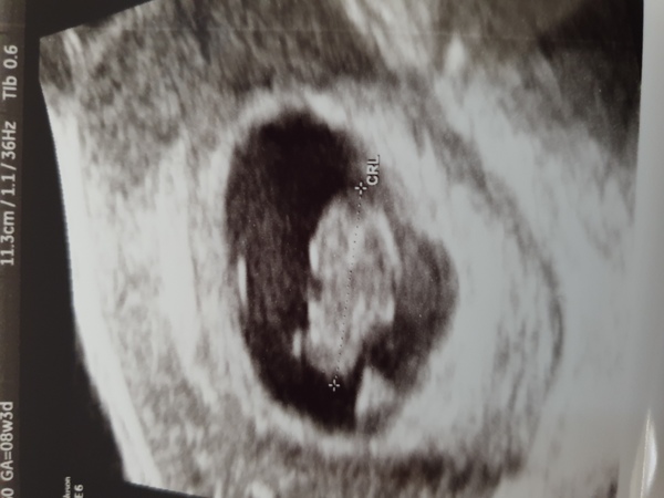 8w6d 