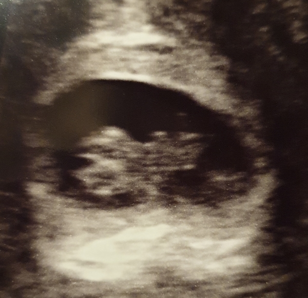 8w6d ♡♡♡