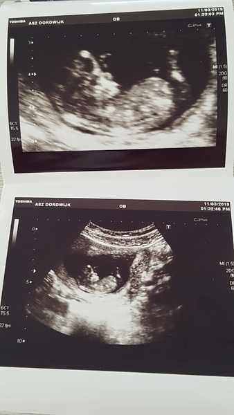 11w 4d Babyyy