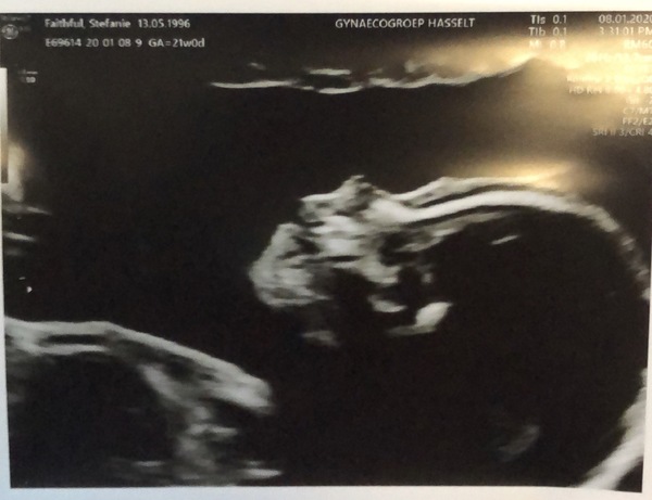  21w3d