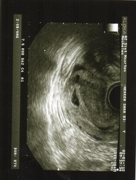 ons 2de kindje  5weken 6dagen oud ons kleine schat