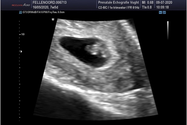  7w6d