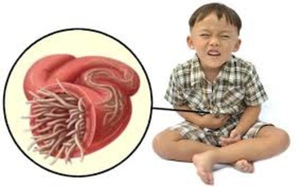 worm infections in children worm infections in children