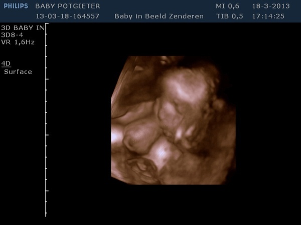 27 en halve week 3D echo 18 maart 2013 2/3/4D echo gehad, 27,5 week, echt heel mooi!!!  