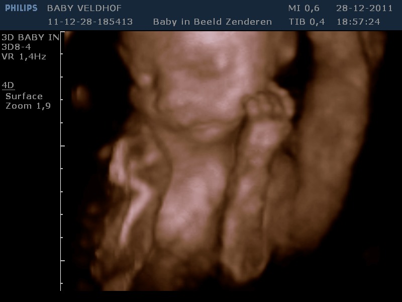 Baby ??? Ons kleine wondertje!!