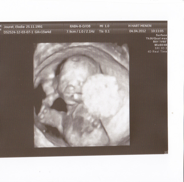 My baby boy  15w en 4d