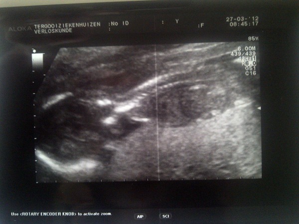 Baby da Costa 16 weken en 4 dagen 