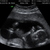 Een zoon 18-1-2012 