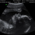 4 d echo 2-4-2012 