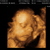4 d echo 2-4-2012 