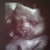  Ons lief kleintje op 28w6d