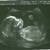 20w 3dagen 