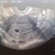 Scan 4 weken en 4 dagen Scan 4 weken en 4 dagen