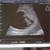 Kloppend hartje :)! 7 weken en 3 dagen Kloppend hartje :)! 7 weken en 3 dagen