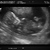 12 weken echo van onze kleine uk 