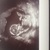  Ons wondertje 