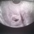 Echo week 7 