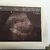 Eerste echo!  