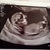 13 wkn echo! 