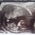 12 weken <3
