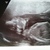 20 wkn 