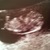 Termijnecho 9wk1dg 