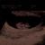 echo 9w2d 