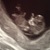 10w3d 