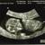  baby 11 w 4d