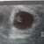 Eerste echo 6w 3d 