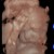 BabyBoy Pretecho  