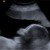 26w 2d 