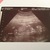 17 weken Echo van de geslachtsbepaling. It's a boy :-) !!