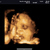 3d echo 