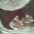 Echo 9w4dagen 