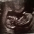  Baby was tijdens de echo echt aan het springen geweest en aant zwaaien met de handjes, zo leuk om te zien :) vingertjes al geteld, teentjes waren nog te klein..