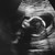  16 weken - it's a boy :D