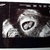 Echo 8w5d 
