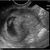 Eerste echo 7w5d 