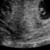  Eerste echo baby nr2